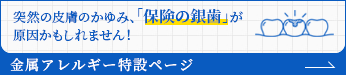 金属アレルギー特設ページ